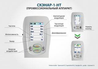 СКЭНАР-1-НТ (исполнение 01)  в Иванове купить Скэнар официальный сайт - denasvertebra.ru 